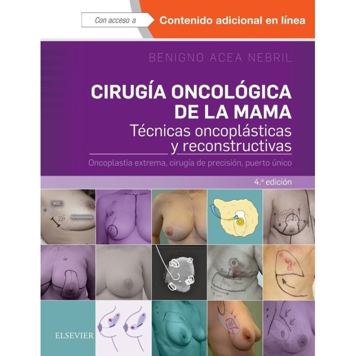 CIRUGIA ONCOLOGICA DE LA MAMA 4ªED