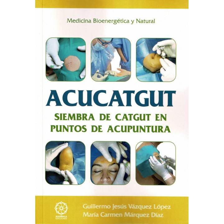 ACUCATGUT SIEMBRA DE CATGUT EN PUNTOS DE ACUPUNTURA