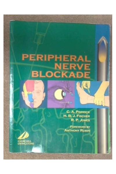 Peripheral Nerve Blockade