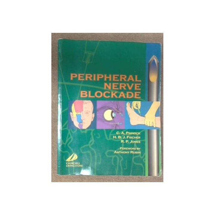 Peripheral Nerve Blockade