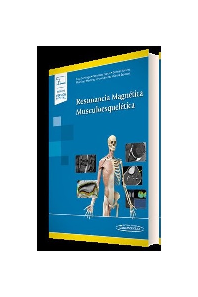 RESONANCIA MAGNETICA MUSCULOESQUELETICA