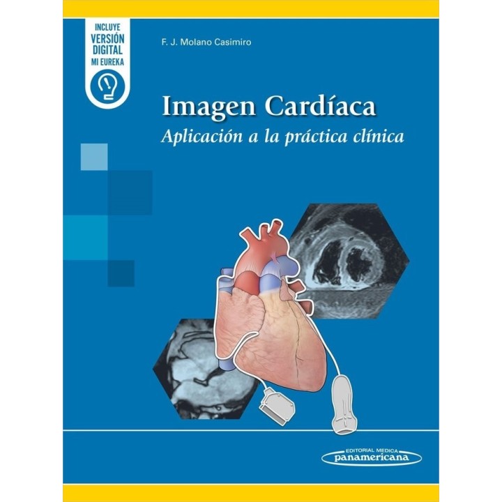 IMAGEN CARDIACA