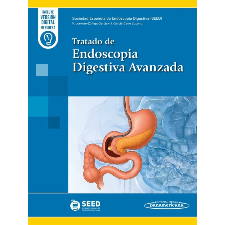 TRATADO DE ENDOSCOPIA DIGESTIVA AVANZADA