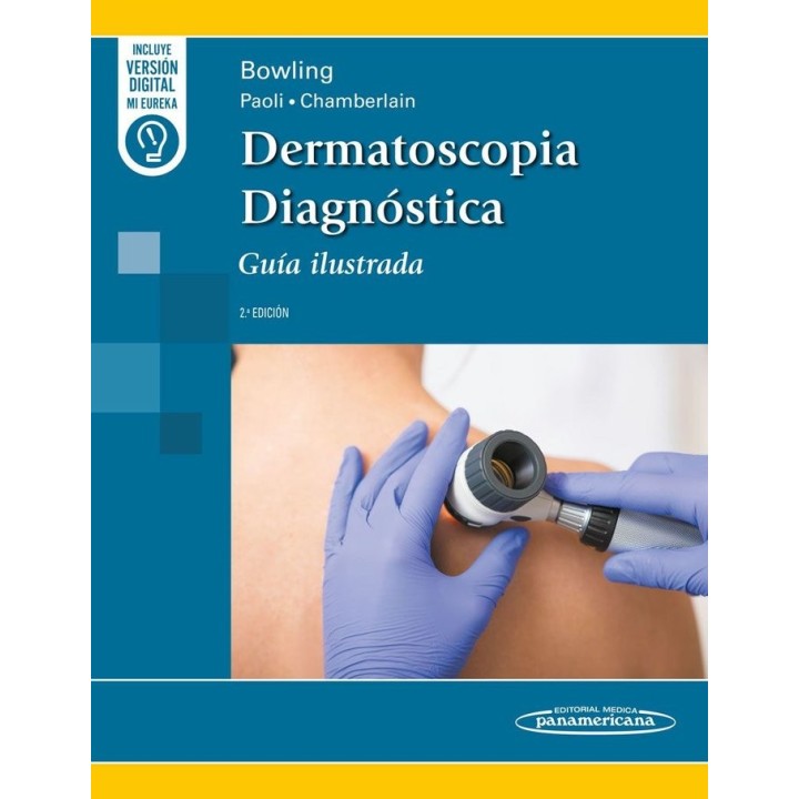 DERMATOSCOPIA DIAGNOSTICA