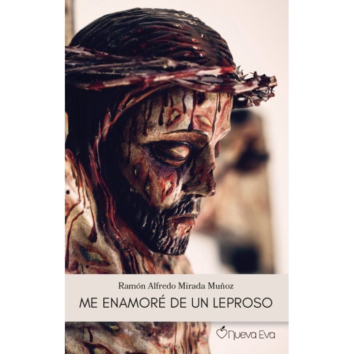 ME ENAMORE DE UN LEPROSO