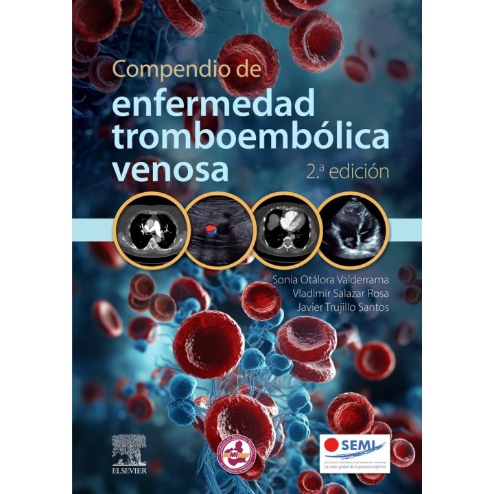COMPENDIO DE ENFERMEDAD TROMBOEMBOLICA VENOSA 2ª ED