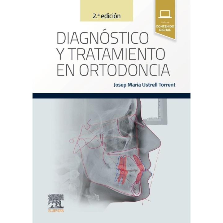 DIAGNOSTICO Y TRATAMIENTO EN ORTODONCIA 2ª EDICION