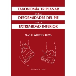 TAXONOMIA TRIPLANAR DE LAS DEFORMIDADES DEL PIE