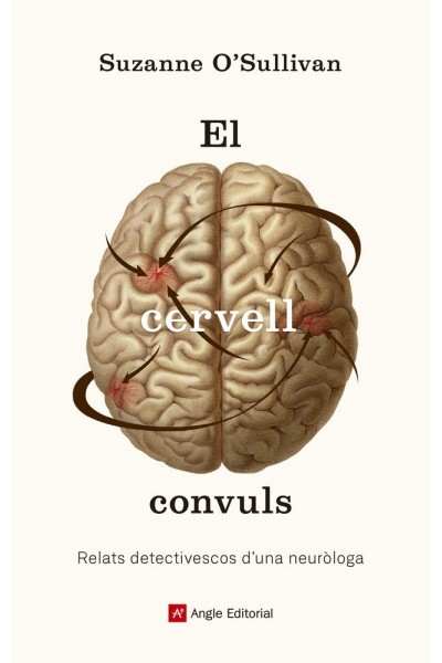 CERVELL CONVULS,EL