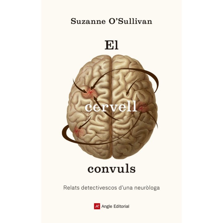CERVELL CONVULS,EL