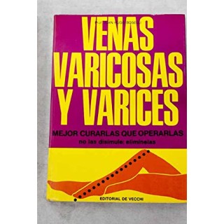 Venas varicosas y varices