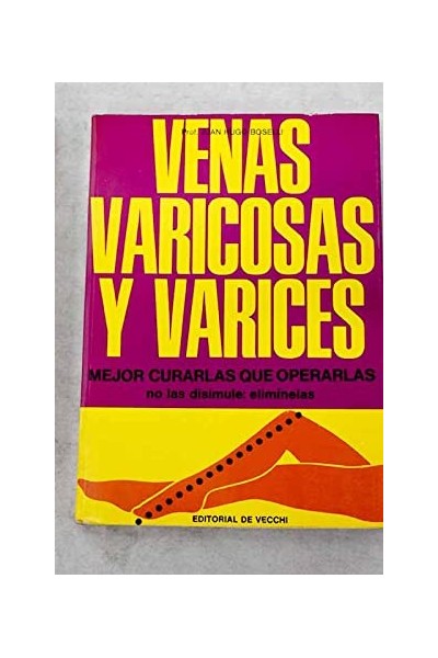 Venas varicosas y varices