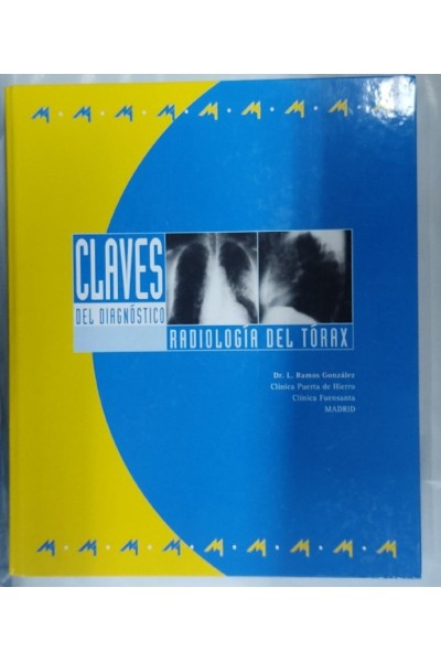 Claves del diagnostico. Radiologia del Torax (Carpeta anillada con 5 Temas + Evaluacion)