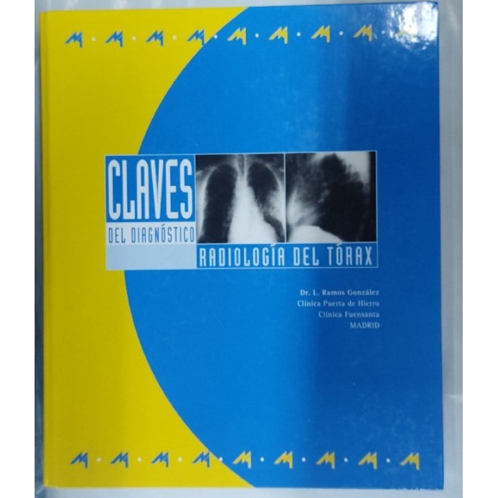 Claves del diagnostico. Radiologia del Torax (Carpeta anillada con 5 Temas + Evaluacion)