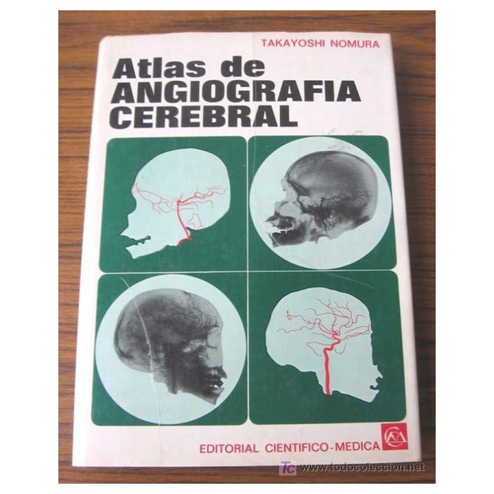 ATLAS DE ANGIOGRAFIA CEREBRAL