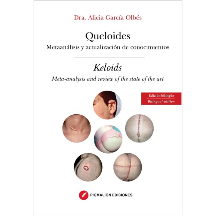 QUELOIDES