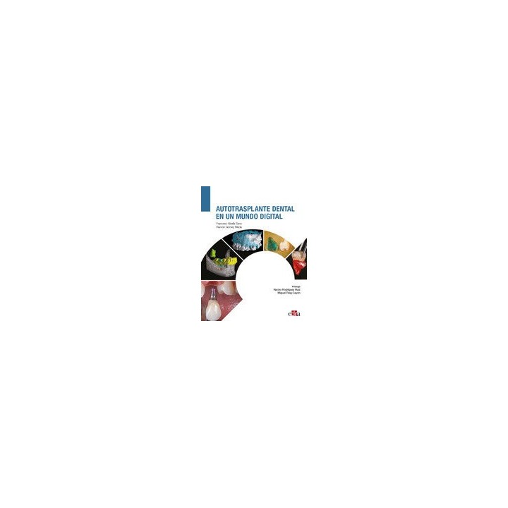 AUTOTRASPLANTE DENTAL EN UN MUNDO DIGITAL