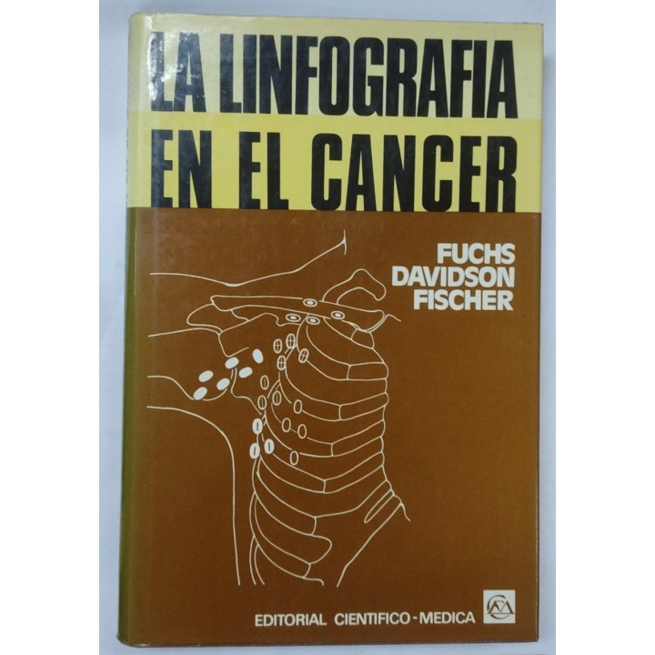 La Linfografía en el Cancer