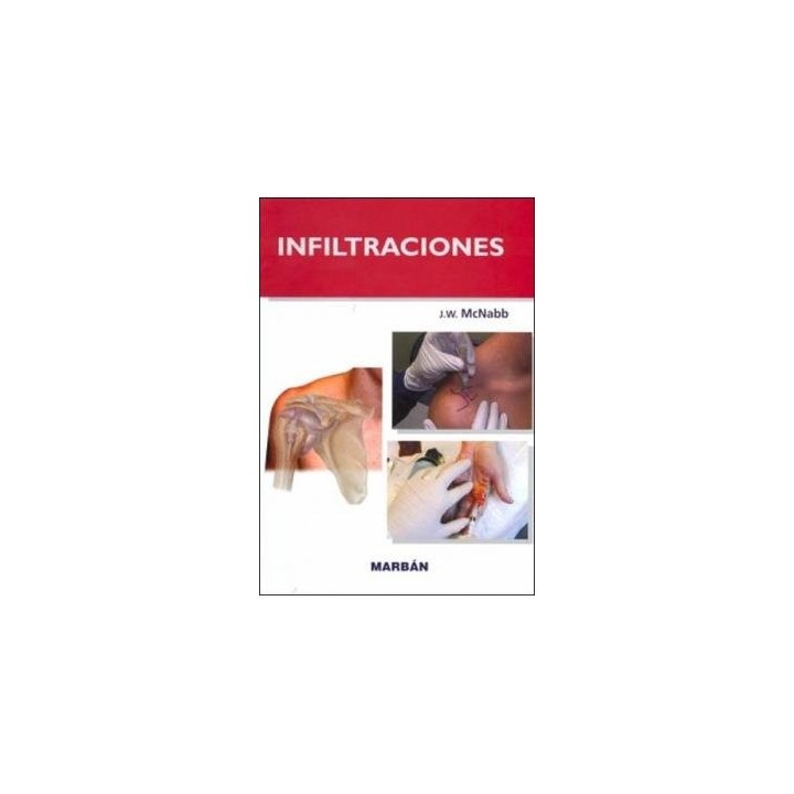 INFILTRACIONES