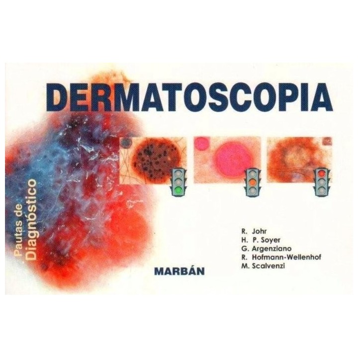 DERMATOSCOPIA. PAUTAS DE DIAGNOSTICO