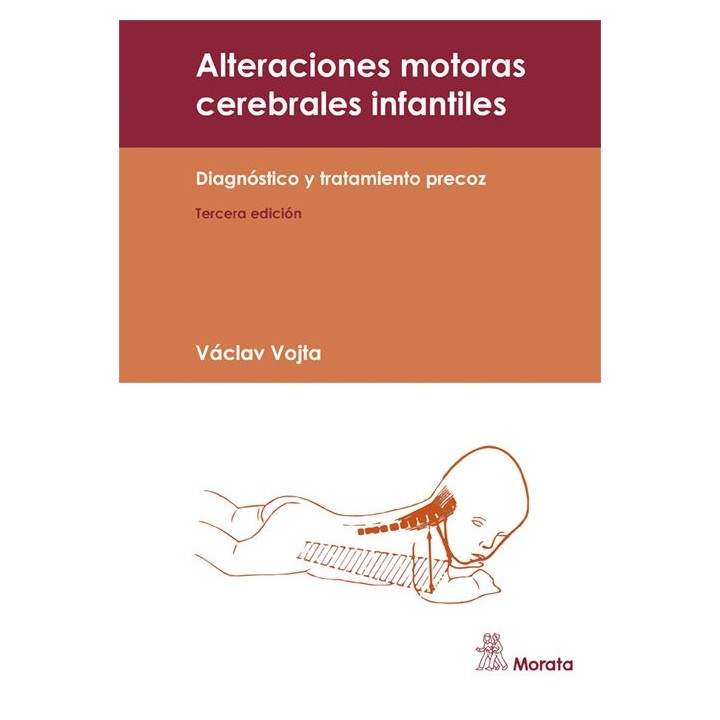 ALTERACIONES MOTORAS CEREBRALES INFANTILES