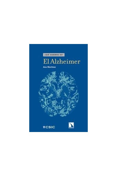 ALZHEIMER,EL