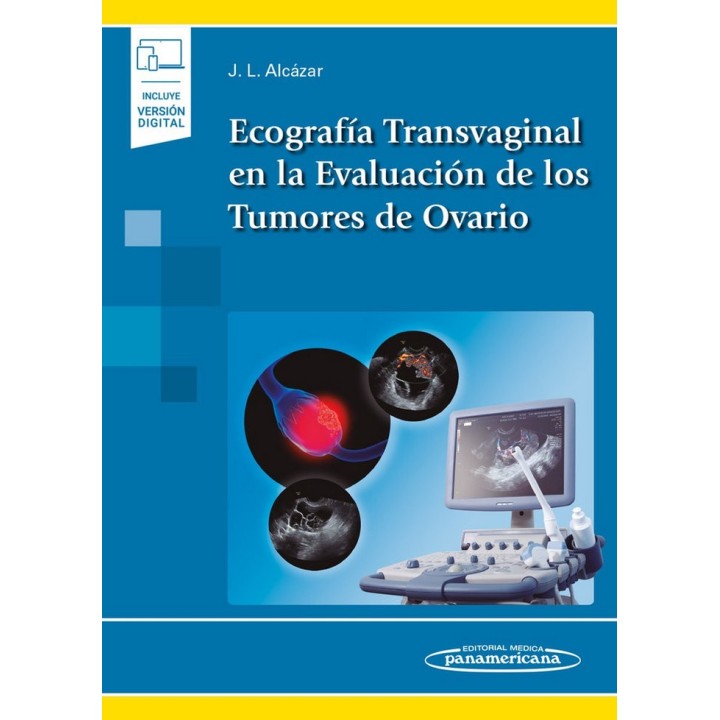 ECOGRAFIA TRANSVAGINAL EN LA EVALUACION DE LOS TUMORES DE OV