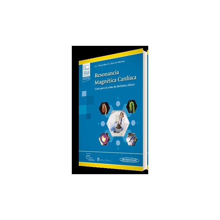 RESONANCIA MAGNETICA CARDIACA