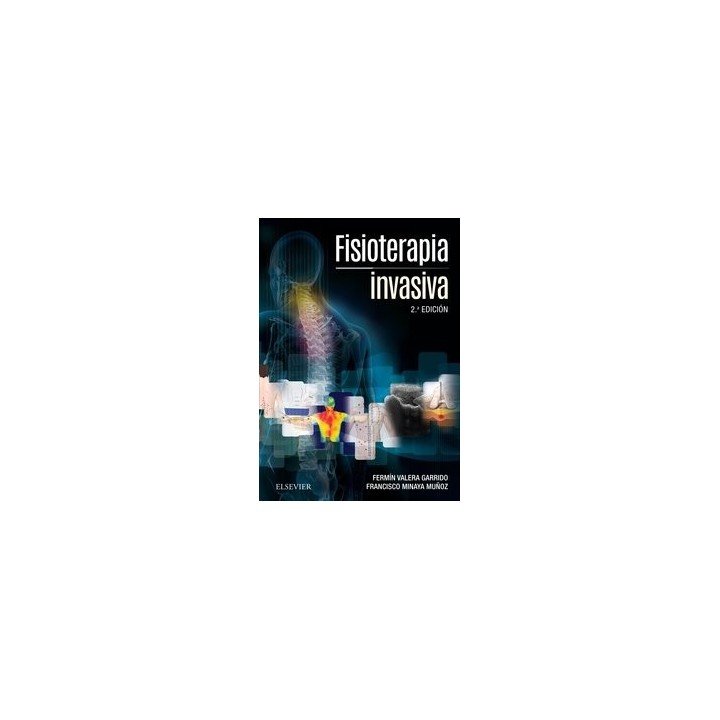 FISIOTERAPIA INVASIVA + ACCESO WEB (2ª ED.)