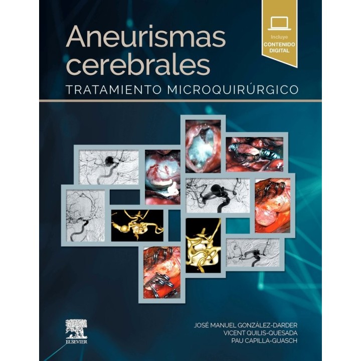 ANEURISMAS CEREBRALES