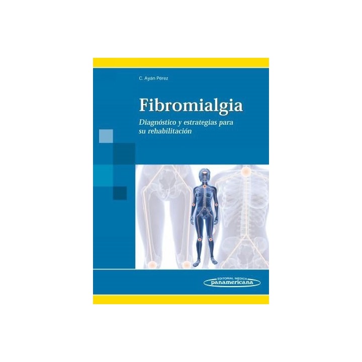 FIBROMIALGIA