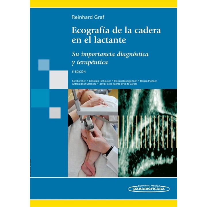 ECOGRAFIA DE LA CADERA EN EL LACTANTE