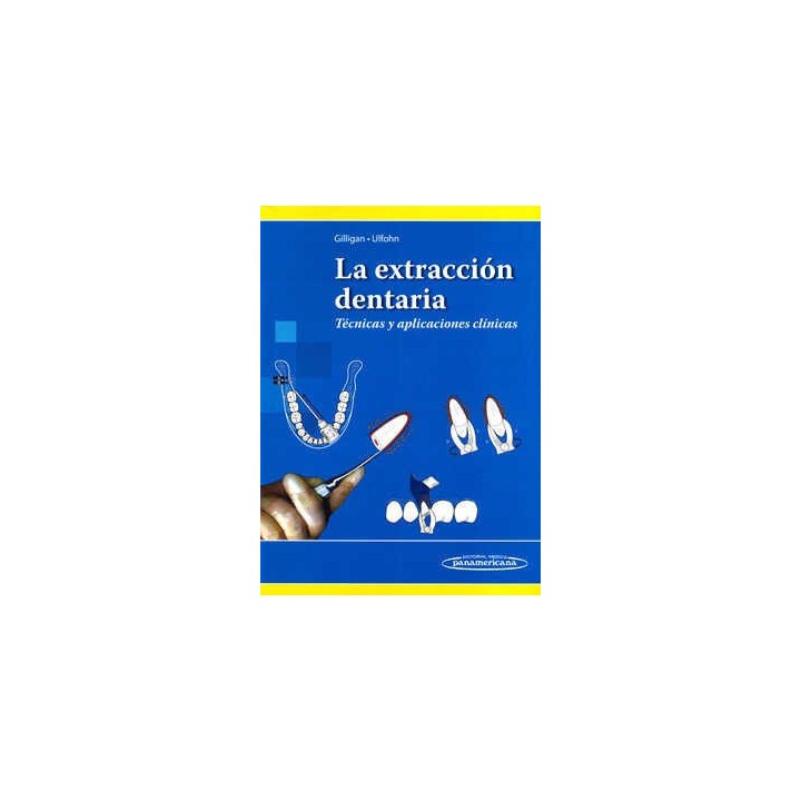 EXTRACCION DENTARIA,LA