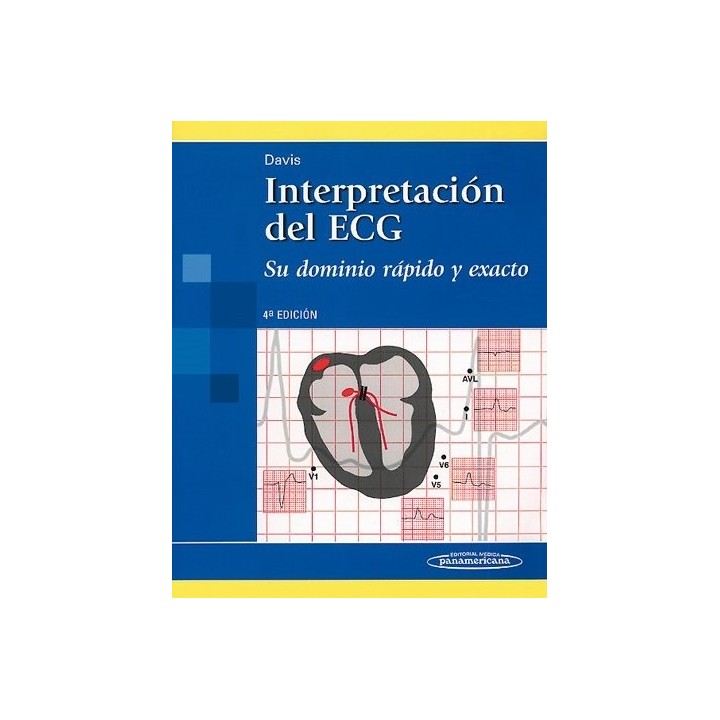 INTERPRETACION DEL ECG.SU DOMINIO RAPIDO Y EXACTO.