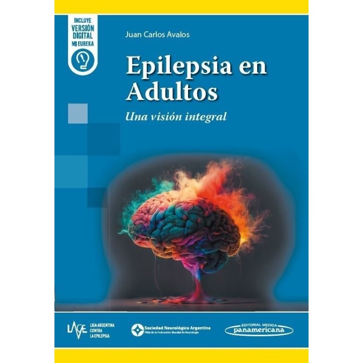 EPILEPSIA EN ADULTOS