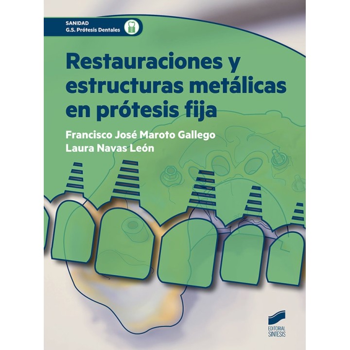 RESTAURACIONES Y ESTRUCTURAS METALICAS EN PROTESIS FIJA