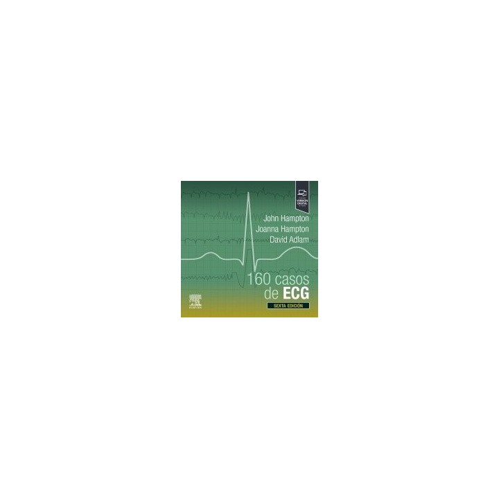 160 CASOS DE ECG 6ª ED