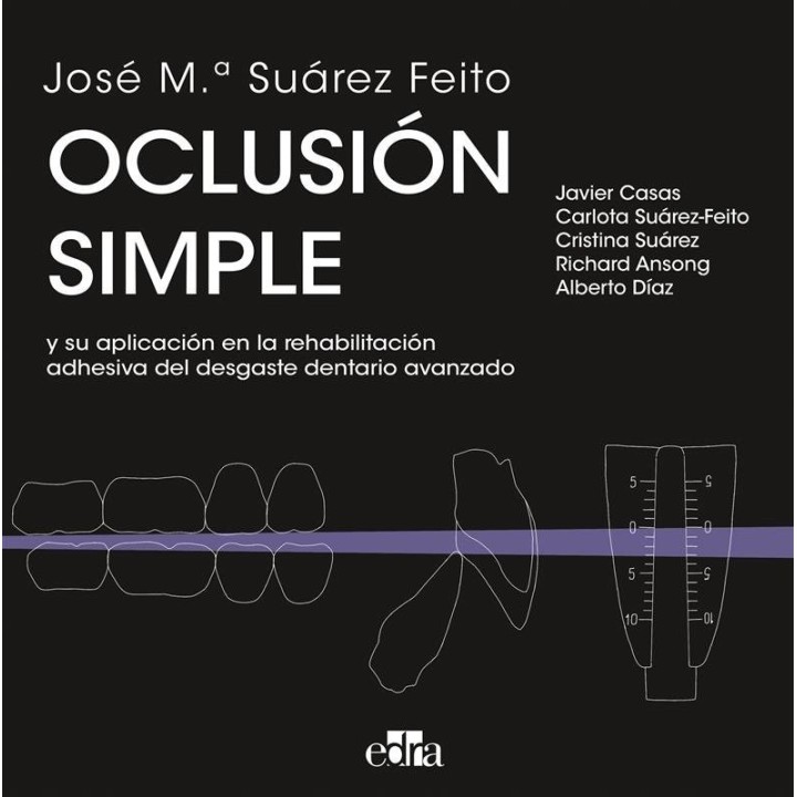 OCLUSION SIMPLE Y SU APLICACION EN LA REHABILITACION ADHESI