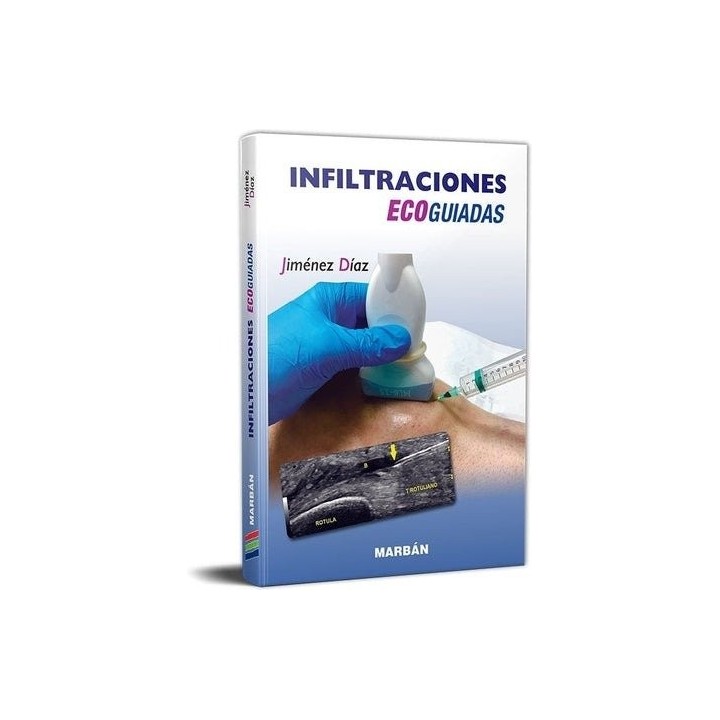 INFILTRACIONES ECOGUIADAS