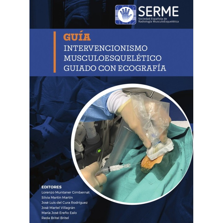 INTERVENCIONISMO MUSCULOESQUELETICO GUIADO CON ECOGRAFIA