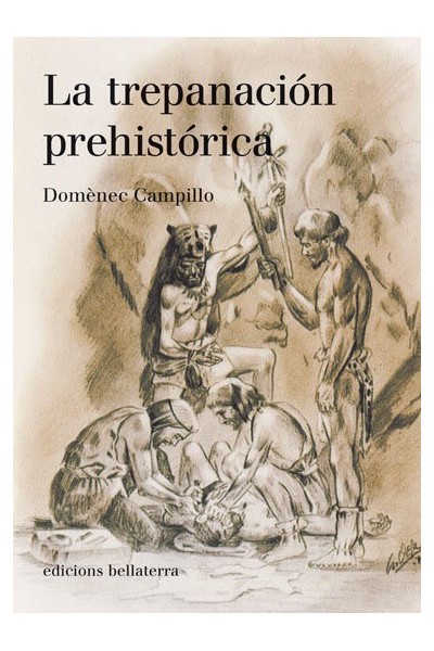 TREPANACION PREHISTORICA,LA