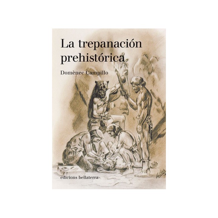 TREPANACION PREHISTORICA,LA
