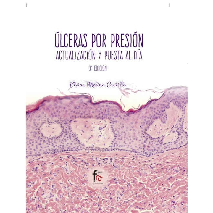 ULCERAS POR PRESION 3ªED