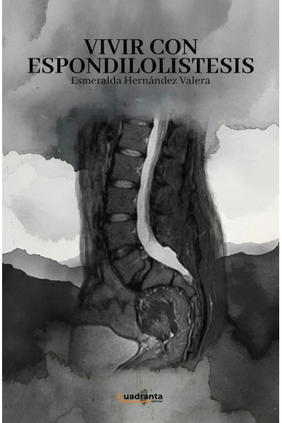 VIVIR CON ESPONDILOLISTESIS