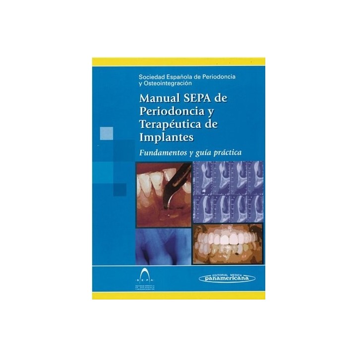 MANUAL S.E.P.A. DE PERIODONCIA Y TERAPEUTICA DE IMPLANTES. F