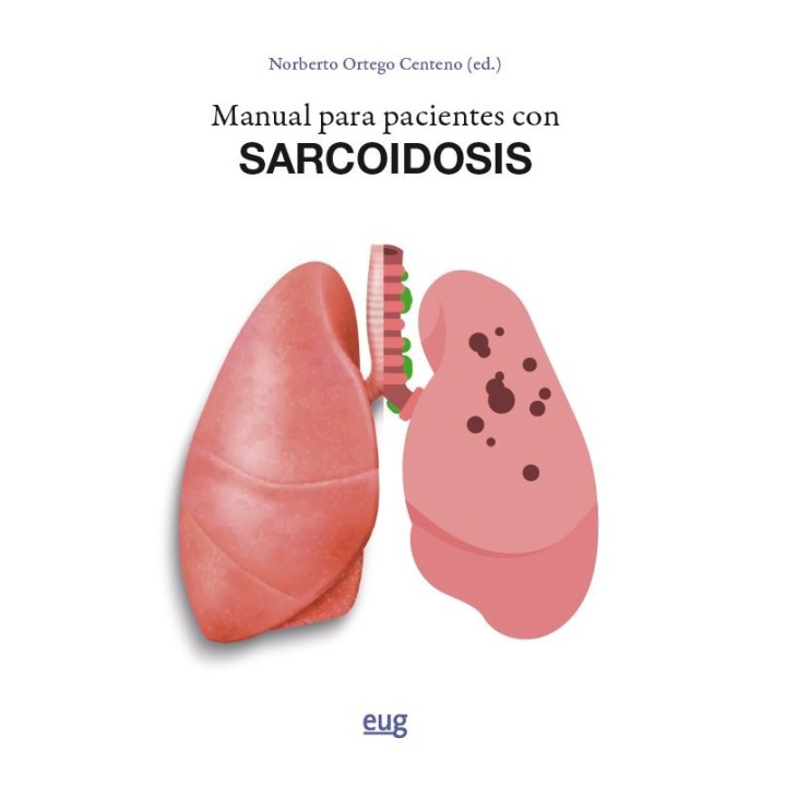 MANUAL PARA PACIENTES CON SARCOIDOSIS