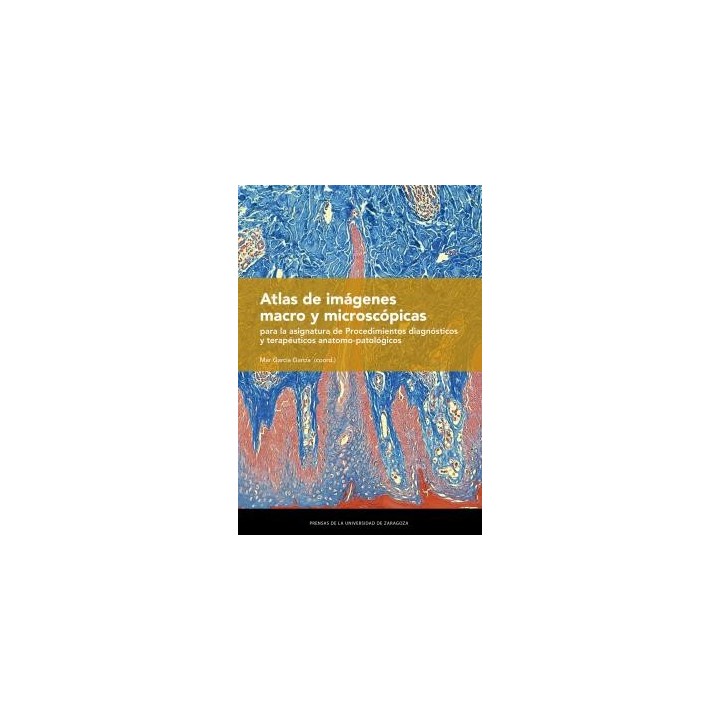 ATLAS DE IMÁGENES MACRO Y MICROSCÓPICAS PARA LA ASIGNATURA DE PROCEDIMIENTOS DIAGNÓSTICOS Y TERAPÉUTICOS ANATOMO-PATOLÓGICOS
