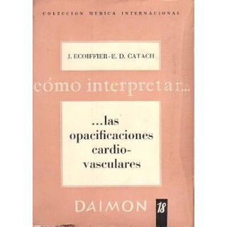 Cómo interpretar Las opacificaciones cardiovasculares