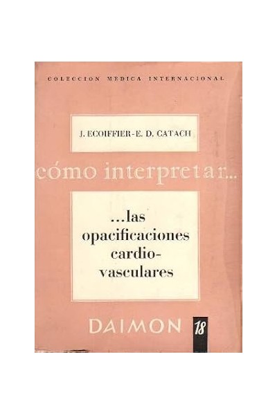 Cómo interpretar Las opacificaciones cardiovasculares