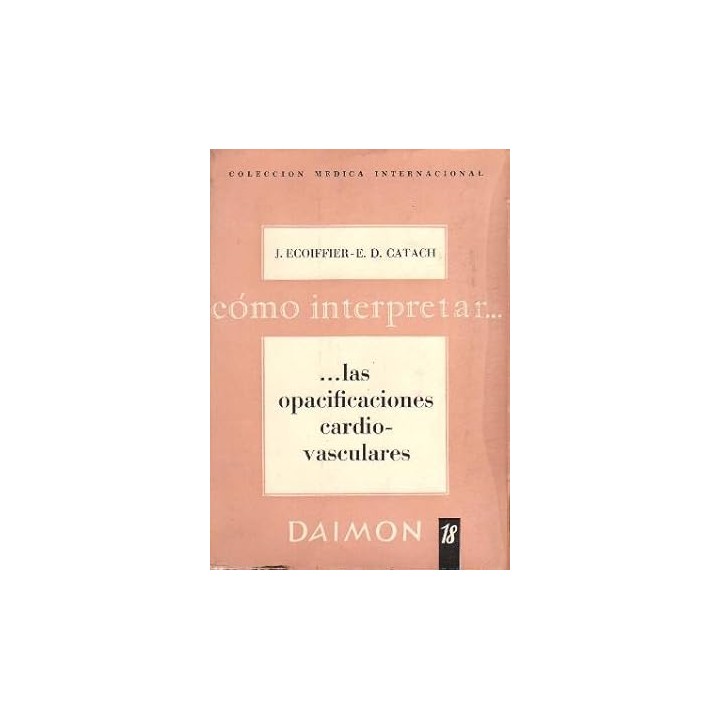 Cómo interpretar Las opacificaciones cardiovasculares